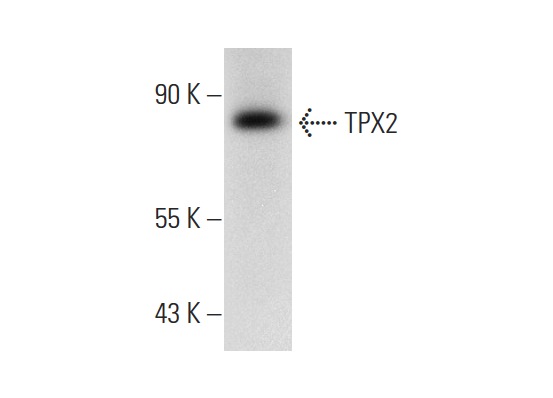  TPX2 (E-2): sc-271570. Western blot analysis of TPX2 expression in SHP-77 whole cell lysate.