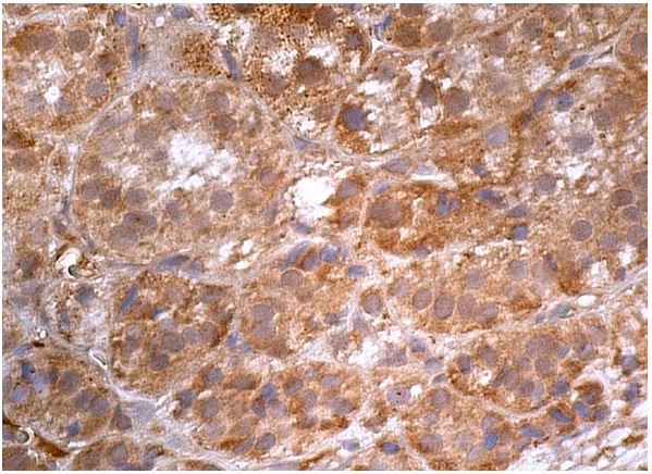  TPX2 (E-2): sc-271570. Immunoperoxidase staining of formalin fixed, paraffin-embedded human adrenal gland tissue showing cytoplasmic staining of glandular cells.