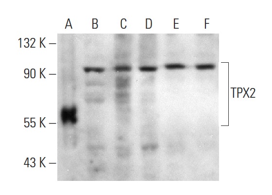  TPX2 (F-17): sc-26274. Western blot analysis of human recombinant TPX2 fusion protein (A) and HeLa (B), K-562 (C), SHP-77 (D), A549 (E) and NIH/3T3 (F) whole cell lysates.