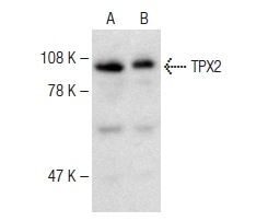  TPX2 (H-300): sc-32863. Western blot analysis of TPX2 expression in K-562 (A) and Jurkat (B) whole cell lysates.