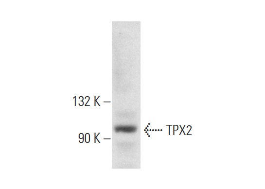  TPX2 (P-17): sc-26276. Western blot analysis of TPX2 expression in SHP-77 whole cell lysate.