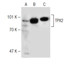  TPX2 (18D5): sc-53775. Western blot analysis of TPX2 expression in HeLa (A), K-562 (B) and Jurkat (C) whole cell lysates.