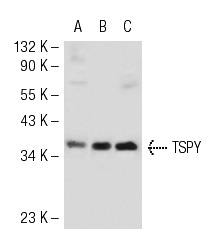  TSPY (H-11): sc-137050. Western blot analysis of TSPY expression in NTERA-2 cl.D1 (A), F9 (B) and AT-3 (C) whole cell lysates.