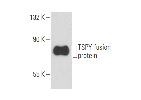  TSPY (H-11): sc-137050. Western blot analysis of human recombinant TSPY2 fusion protein.