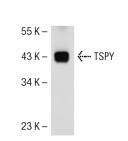  TSPY (H-120): sc-68431. Western blot analysis of TSPY expression in LNCaP whole cell lysate.