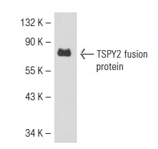  TSPY (H-120): sc-68431. Western blot analysis of human recombinant TSPY2 fusion protein.