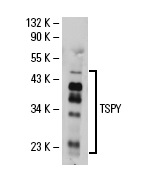  TSPY (SF-7): sc-69844. Western blot analysis of TSPY expression in human testis tissue extract.