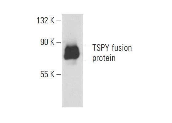  TSPY (SF-7): sc-69844. Western blot analysis of human recombinant TSPY2.