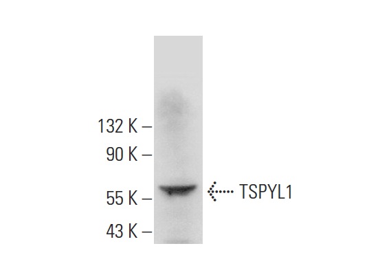  TSPYL1 (E-15): sc-169708. Western blot analysis of TSPYL1 expression in human kidney tissue extract.