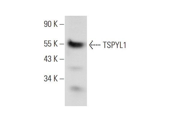  TSPYL1 (E-15): sc-169708. Western blot analysis of TSPYL1 expression in Raji whole cell lysate.