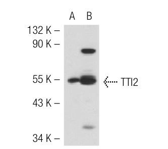  C8orf41 (S-12): sc-87597. Western blot analysis of C8orf41 expression in Jurkat (A) and human PBL (B) whole cell lysates.