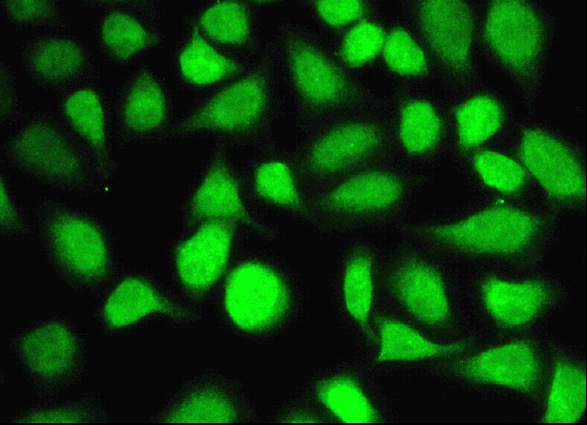  ZBED4 (N-18): sc-86942. Immunofluorescence staining of formalin-fixed HeLa cells showing nucleolar and nuclear localization. Kindly provided by Yang Xiang, Ph.D., Division of Newborn Medicine, Boston Childrens Hospital, Cell Biology Department, Harvard Medical School.