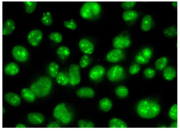  ZBED4 (N-18): sc-86942. Immunofluorescence staining of formalin-fixed HeLa cells showing nucleolar and nuclear localization. Kindly provided by Yang Xiang, Ph.D., Division of Newborn Medicine, Boston Childrens Hospital, Cell Biology Department, Harvard Medical School.