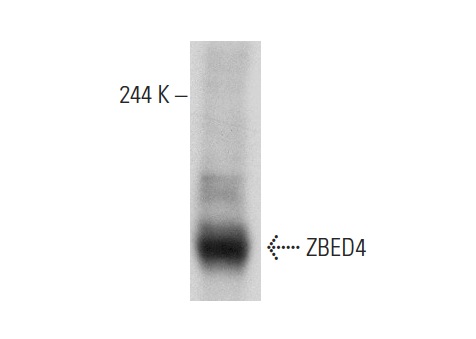  ZBED4 (N-18): sc-86942. Western blot analysis of ZBED4 expression in HeLa whole cell lysate.