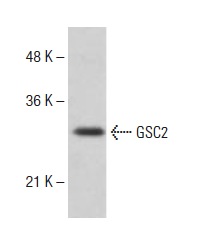  GSC2 (T-24): sc-133639. Western blot analysis of GSC2 expression in Hep G2 whole cell lysate.