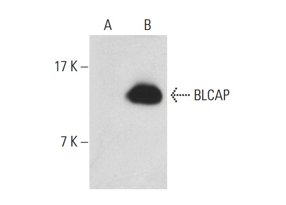  BLCAP (C-12): sc-85301. Western blot analysis of BLCAP expression in non-transfected: sc-117752 (A) and human BLCAP transfected: sc-116163 (B) 293T whole cell lysates.