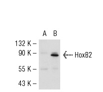  HoxB2 (R-100): sc-28605. Western blot analysis of HoxB2 expression in non-transfected: sc-117752 (A) and mouse HoxB2 transfected: sc-125466 (B) 293T whole cell lysates.