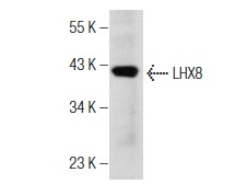  LHX8 (M-16): sc-22217. Western blot analysis of LHX8 expression in rat liver tissue extract.