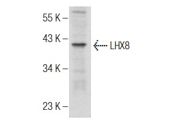  LHX8 (S-12): sc-22216. Western blot analysis of LHX8 expression in rat liver tissue extract.