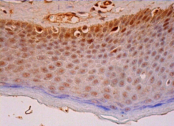  BRCA1 (287.17): sc-135732. Immunoperoxidase staining of formalin fixed, paraffin-embedded human vulva/anal skin tissue showing nuclear and cytoplasmic staining of epidermal cells.