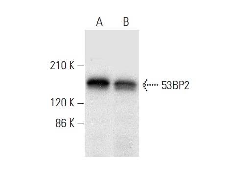  53BP2 (H-4): sc-398311. Western blot analysis of 53BP2 expression in HeLa (A) and MCF7 (B) whole cell lysates.