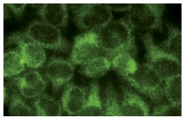  Alix (1A12): sc-53540. Immunofluorescence staining of methanol-fixed HeLa cells showing cytoplasmic localization.