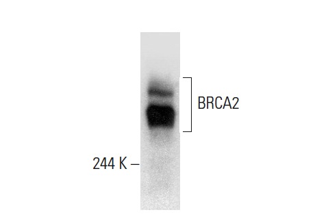  BRCA2 (I-17): sc-1818. Western blot analysis of BRCA2 expression in MDA-MB-231 whole cell lysate.