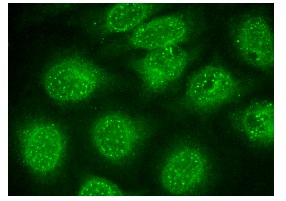  BRCA2 (I-17): sc-1818. Immunofluorescence staining of methanol-fixed HeLa cells showing nuclear localization.