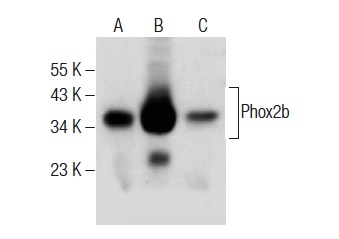  Phox2b (B-11): sc-376997. Western blot analysis of Phox2b expression in SK-N-SH (A), IMR-32 (B) and Neuro-2a (C) whole cell lysates.