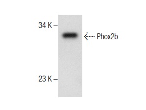  Phox2b (C-20): sc-13226. Western blot analysis of Phox2b expression in human stomach tissue extract.