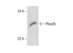  Phox2b (N-14): sc-48627. Western blot analysis of Phox2b expression in SK-N-SH whole cell lysate.