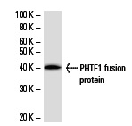  PHTF1 (PHTF1R8): sc-81111 Western Blot analysis of human recombinant PHTF1 fusion protein.