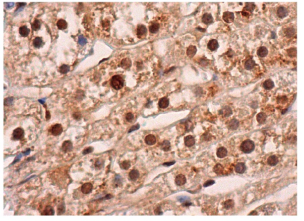  BRCA2 (H-299): sc-28235. Immunoperoxidase staining of formalin fixed, paraffin-embedded human adrenal gland tissue showing nuclear and cytoplasmic staining of glandular cells.