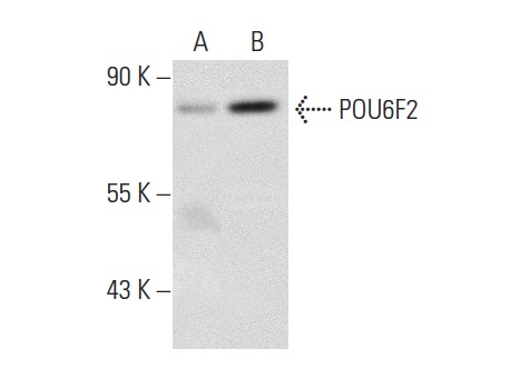  POU6F2 (M-17): sc-104627. Western blot analysis of POU6F2 expression in non-transfected: sc-117752 (A) and human POU6F2 transfected: sc-175222 (B) 293T whole cell lysates.