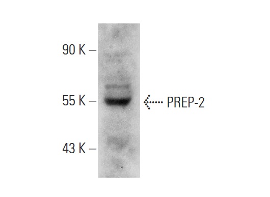  PREP-2 (T-20): sc-55892. Western blot analysis of PREP-2 expression in IMR-32 whole cell lysate.