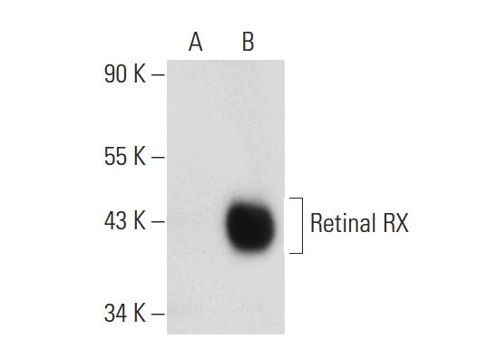  Retinal RX (G-12): sc-271889. Western blot analysis of Retinal RX expression in non-transfected: sc-117752 (A) and mouse Retinal RX transfected: sc-123075 (B) 293T whole cell lysates.