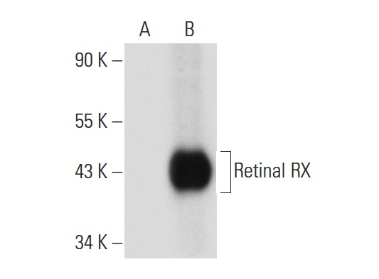  Retinal RX (G-12): sc-271889. Western blot analysis of Retinal RX expression in non-transfected: sc-117752 (A) and mouse Retinal RX transfected: sc-123076 (B) 293T whole cell lysates.