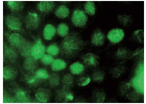  Retinal RX (G-12): sc-271889. Immunofluorescence staining of methanol-fixed HeLa cells showing nuclear localization.