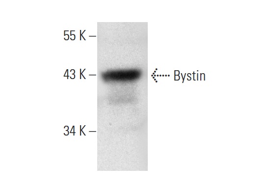  Bystin (A-10): sc-271722. Western blot analysis of Bystin expression in HeLa whole cell lysate.