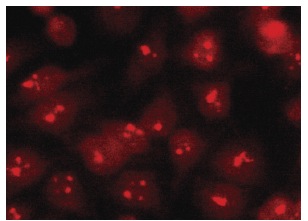  Bystin (A-10): sc-271722. Immunofluorescence staining of methanol-fixed HeLa cells showing nucleolar and nuclear localization.