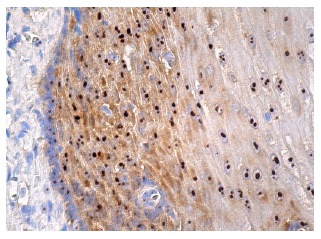  Bystin (A-10): sc-271722. Immunoperoxidase staining of formalin fixed, paraffin-embedded human esophagus tissue showing nucleolar and cytoplasmic staining of squamous epithelial cells. 