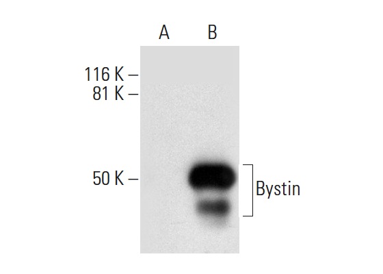  Bystin (A-10): sc-271722. Western blot analysis of Bystin expression in non-transfected: sc-117752 (A) and mouse Bystin transfected: sc-118882 (B) whole cell lysates.