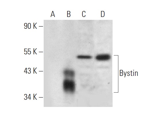  Bystin (F-7): sc-393616. Western blot analysis of Bystin expression in non-transfected 293T: sc-117752 (A), mouse Bystin transfected 293T: sc-118882 (B), HeLa (C) and Jurkat (D) whole cell lysates.