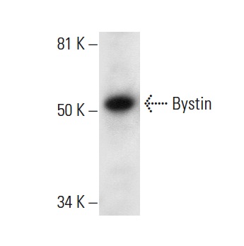  Bystin (F-7): sc-393616. Western blot analysis of Bystin expression in HeLa nuclear extract.