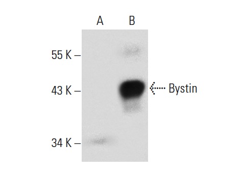  Bystin (G-1): sc-271554. Western blot analysis of Bystin expression in non-transfected: sc-117752 (A) and human Bystin transfected: sc-116274 (B) 293T whole cell lysates.