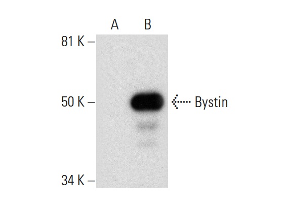  Bystin (G-1): sc-271554. Western blot analysis of Bystin expression in non-transfected: sc-117752 (A) and mouse Bystin transfected: sc-118882 (B) 293T whole cell lysates.