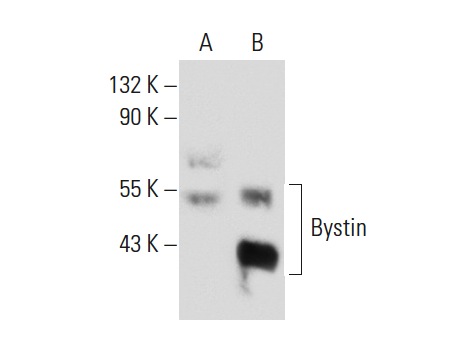  Bystin (H-300): sc-134978. Western blot analysis of Bystin expression in non-transfected: sc-117752 (A) and human Bystin transfected: sc-116274 (B) 293T whole cell lysates.