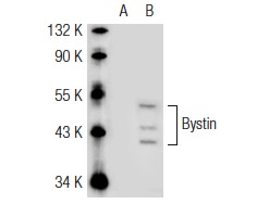  Bystin (Q-17): sc-67525. Western blot analysis of Bystin expression in non-transfected: sc-117752 (A) and mouse Bystin transfected: sc-118882 (B) 293T whole cell lysates.