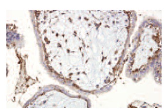  Bystin (clone 19): sc-80001. Immunoperoxidase staining of formalin fixed, paraffin-embedded human placenta tissue showing cytoplasmic staining.