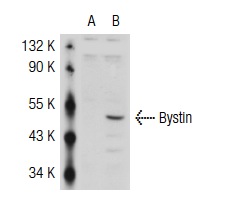  Bystin (C-19): sc-67523. Western blot analysis of Bystin expression in non-transfected: sc-117752 (A) and human Bystin transfected: sc-116274 (B) 293T whole cell lysates.